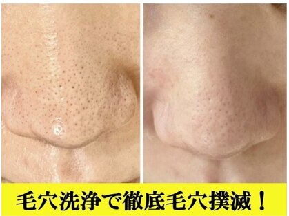 イリゼ(iriser)の写真