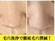 イリゼ(iriser)の写真