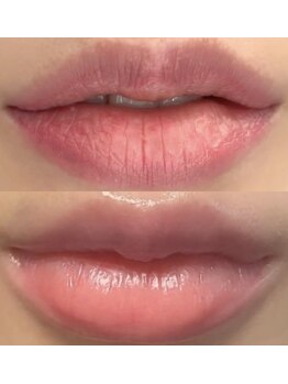 ネイルサロン クイーン(Nail Salon Queen)の写真/《ローマピンク導入☆唇¥99000♪》唇など色味が気になる箇所へアプローチ！本来の美しいピンク色へ◎