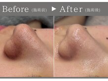 エミエル(EMIER)の雰囲気（【毛穴を徹底ケア】韓国最先端スキンジェクションで肌質改善♪）