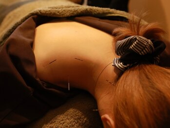 オリエントセラピー(ORIENT THERAPY)の写真/【ルート鍼・レディース鍼・秘鍼・鬼神美容鍼】によって圧倒的な効果を皆様にお届けいたします。