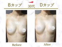 Ms.やまとなでしこ/ビフォーアフター