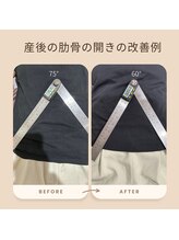 和ぎ整体院/肋骨矯正で改善