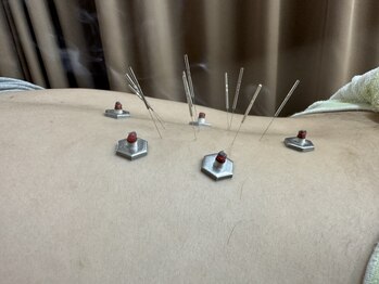 七草はり灸マッサージ院の写真/深いお悩みもお任せください。心理学に造詣の深い院長がお気持ちに寄り添った丁寧なヒアリングを行います。