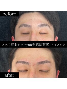 ユー 千葉駅前店(you)/ビフォ－アフター写真