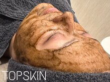 トップスキン 久屋大通(TOPSKIN)/ダウンタイムはとっても緩やか♪