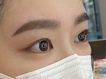 ビューティーガーデン イース/AFTER