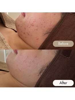 メイクス(Makes)/剥離なし♪漢方ハーブ