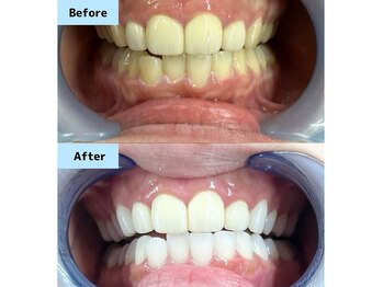 プロケアホワイトニング 池袋店