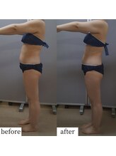 アップルミント/＜痩身＞before・after