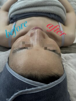 ファーファラ(Farfalla)/EMS×AIRBARI