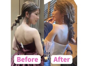 ボディキュア ブライダル美容整体 大阪梅田/理想の「華奢見え」に/梅田/大阪