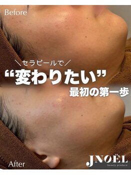 ジェノール 2nd beauty studio 姫路駅前店(JNOEL)/変わりたい第一歩セラピール
