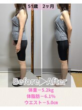 ウル(ulu)/ダイエット/痩身/耳ツボ/腸活