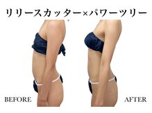 リノア(Linoa)/リリースカッター×パワーツリー