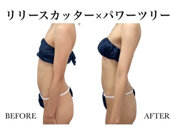 リノア(Linoa)/リリースカッター×パワーツリー