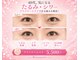 ビジューアイズ(Bijou eyes)の写真