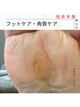 ピーアンドオー(P&O)/