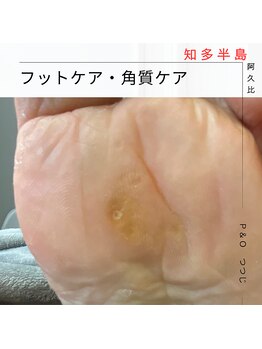 ピーアンドオー(P&O)/