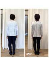 ウォーブ(Wobe)/一回の施術で背筋がピーン