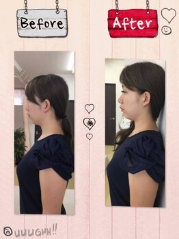 ビューティーバランスボディ 岡崎レディース整体院(beauty balance body)/【岡崎/整体/女性/肩こり/腰痛】