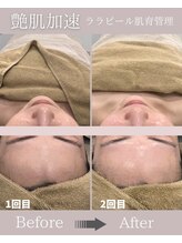 サロンフロム つくば店(Salon From)/◆肌育ララピールフェイシャル◆