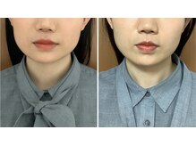 ビューティフルムーン(Beautiful Moon)/エラ・スッキリ♪