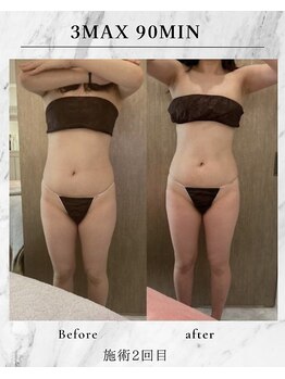 ラズリ(Lazuli)/浮腫みもスッキリ