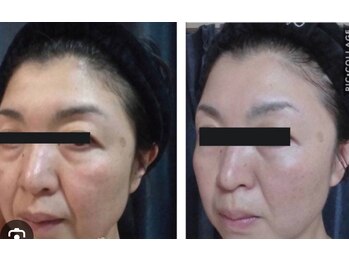 エリール(elire)/核酸DNAミネラル酵素ケア