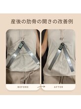 和ぎ整体院/肋骨矯正で改善