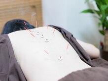 ～女性専用～四季の声 はりきゅう治療院 横浜鶴見[妊活/美容鍼/マタニティ/鍼灸整体]/施術【妊活/美容鍼/鍼灸整体】