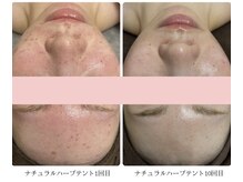 リヴィアス(Re:vias)/