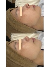 サロンモア(salon More)/LED美容