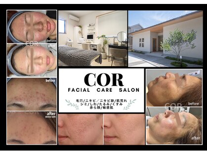 コル(COR)の写真