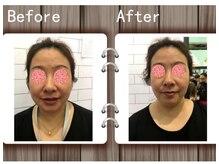 アゴラ/【小顔】中国のイベント会場にて