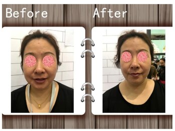 アゴラ/【小顔】中国のイベント会場にて