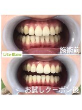 ルブラン 奈良店(Le Blanc)/誰もが一度は