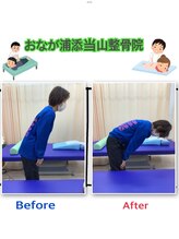 おなが浦添当山整骨院/腰の可動域、超改善♪