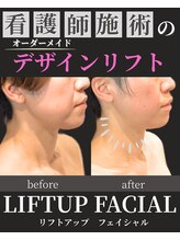 ノーブルノアール(Noble noir)/もたつき撃退リフト