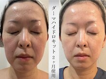 ミヨンラボ(miyon LABO)