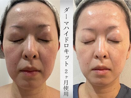 ミヨンラボ(miyon LABO)の写真