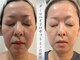 ミヨンラボ(miyon LABO)の写真