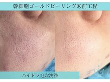 リメイク 広尾(REMAKE)/