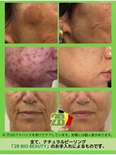 隠れ家サロンluminary仙台五橋【毛穴/ニキビケア/ピーリング/小顔/オイルマッサージ】/2Bハーブピーリング