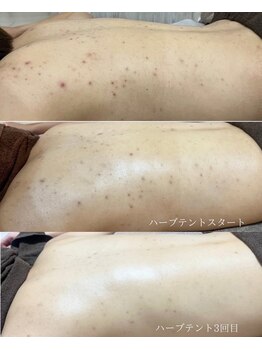 リヴィアス(Re:vias)/