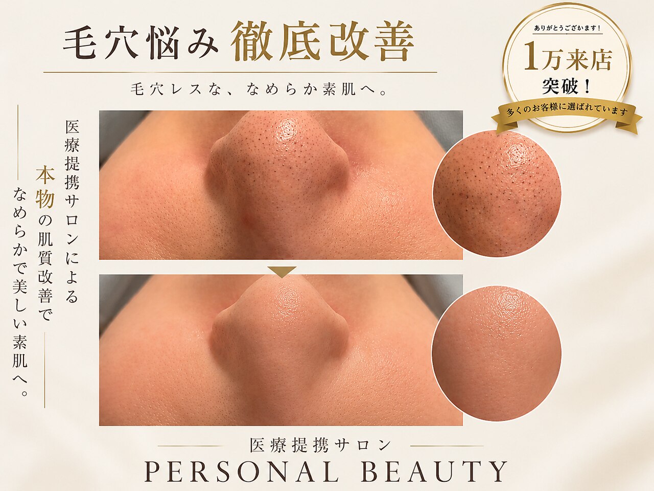ホットペッパービューティ PB｜ホットペッパービューティー