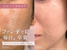 エープラス 日立(Aplus)/「肌きれいだね」と言われる素肌
