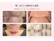 ホワイトアクア 北千住店(WHITE AQUA)の写真/【韓国式ララピール導入★】】話題のララピール×毛穴洗浄で、お肌悩みの改善で理想の美肌GET☆