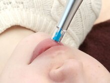 アイル(iru)/リゼネレート目尻・唇OK