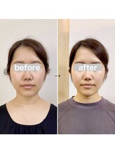 横浜DRT矯正院/小顔・美顔矯正